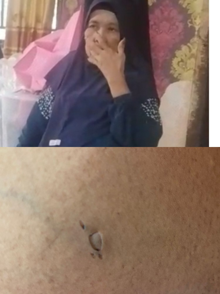 Nenek Lansia Korban Penganiayaan di Ulak Patian Desak Polsek Kepenuhan Tangkap Pelaku