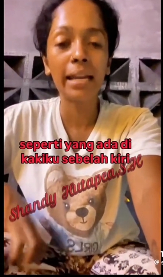 Lapor Balik Saraswati dan Akun Medsos Yang Cemarkan Nama Baik, Dr.Tomy Aditya Sinulingga,S.H, M.H: Akal-akalan Pelapor karena sudah Damai Sepihak 
